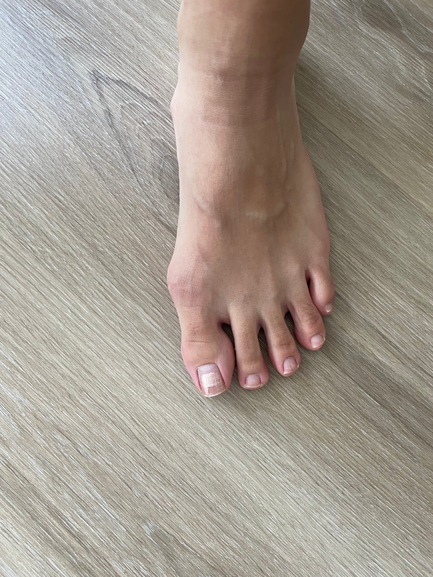 Jelly Toe Separators